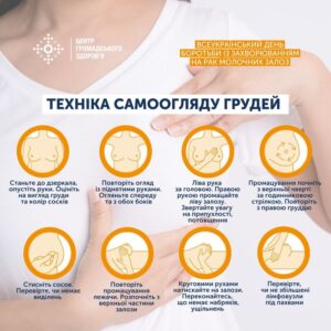 Рак молочної залози