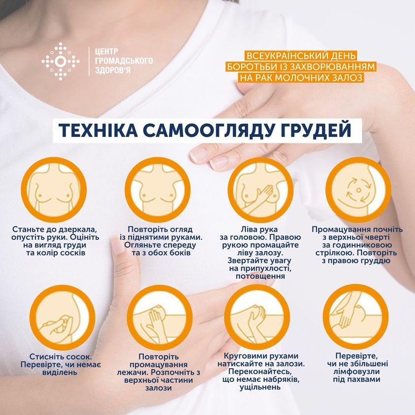 Рак молочної залози