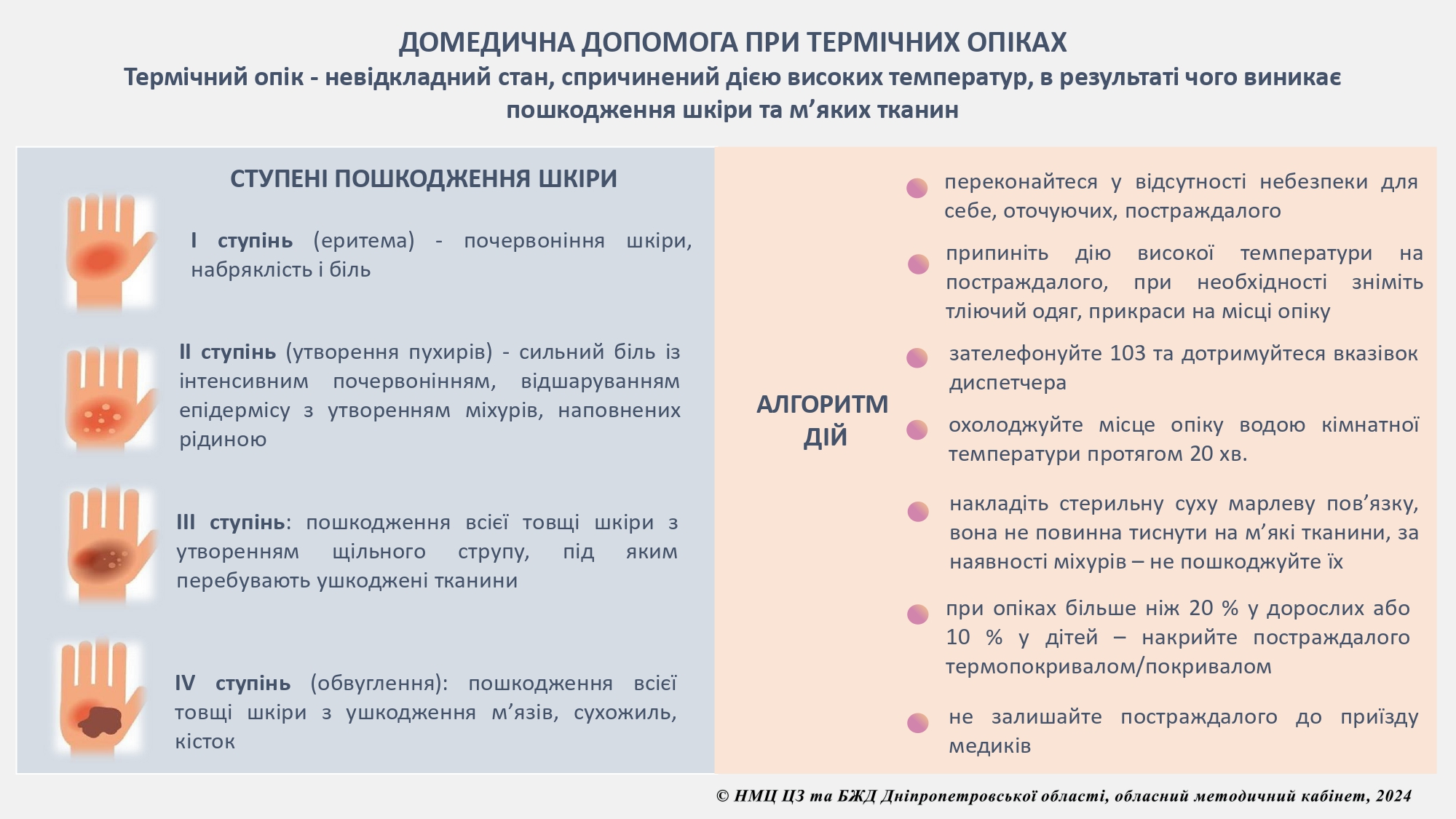 Пам'ятка на тему: " Домедична допомога при термічних опіках"